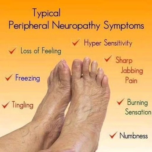 acetyl-l-carnitine taxol neuropathy Tingling in your hands or feet might seem minor during cancer treatment but it can be an early sign of something more serious. Peripheral #neuropathy, a common side effect of certain chemotherapy Dosage:10mg (best value) fitless S-Acetyl Glutathione Synergy 60s