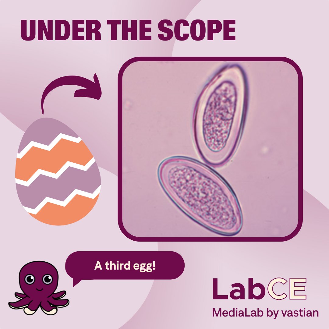 Welcome to Under the Scope with... - Labce by MediaLab | Facebook