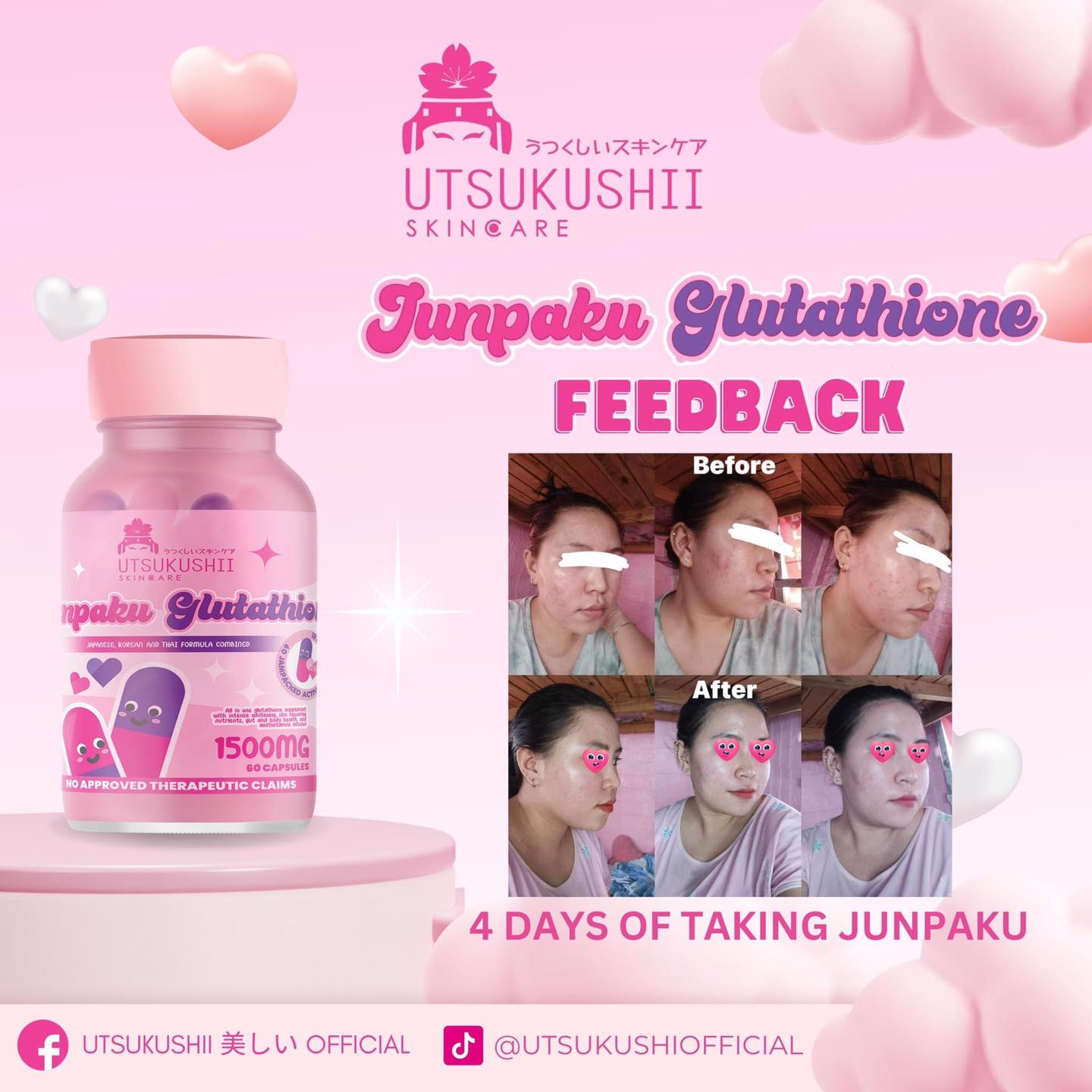 junpaku glutathione Utsukushī 美しい (@UtsukushiMain) • Facebook Bloom Ultra Kojic Whitening