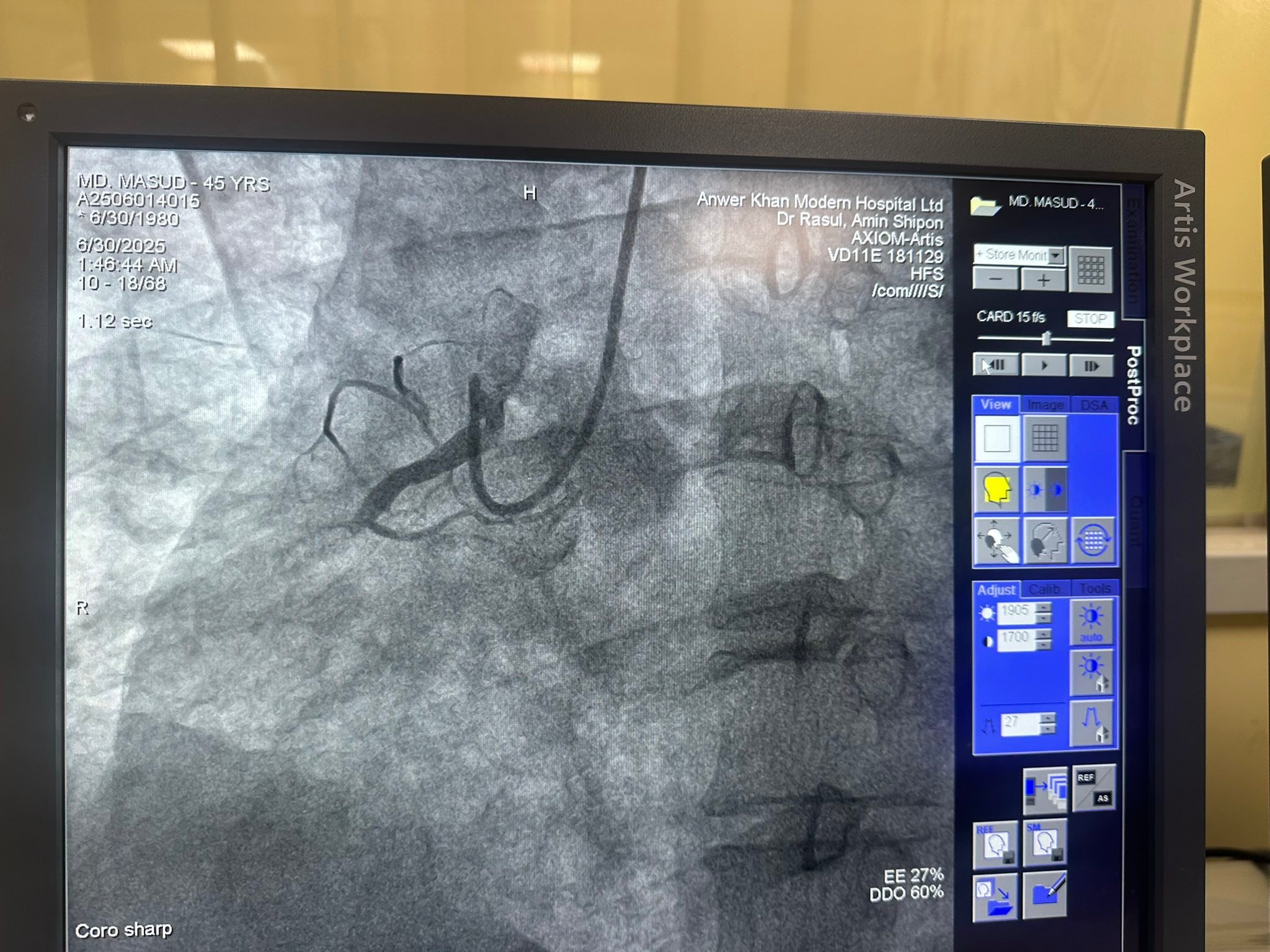 Dr. Md Rasul Amin Shepon, Interventional Cardiologist | Dhaka
