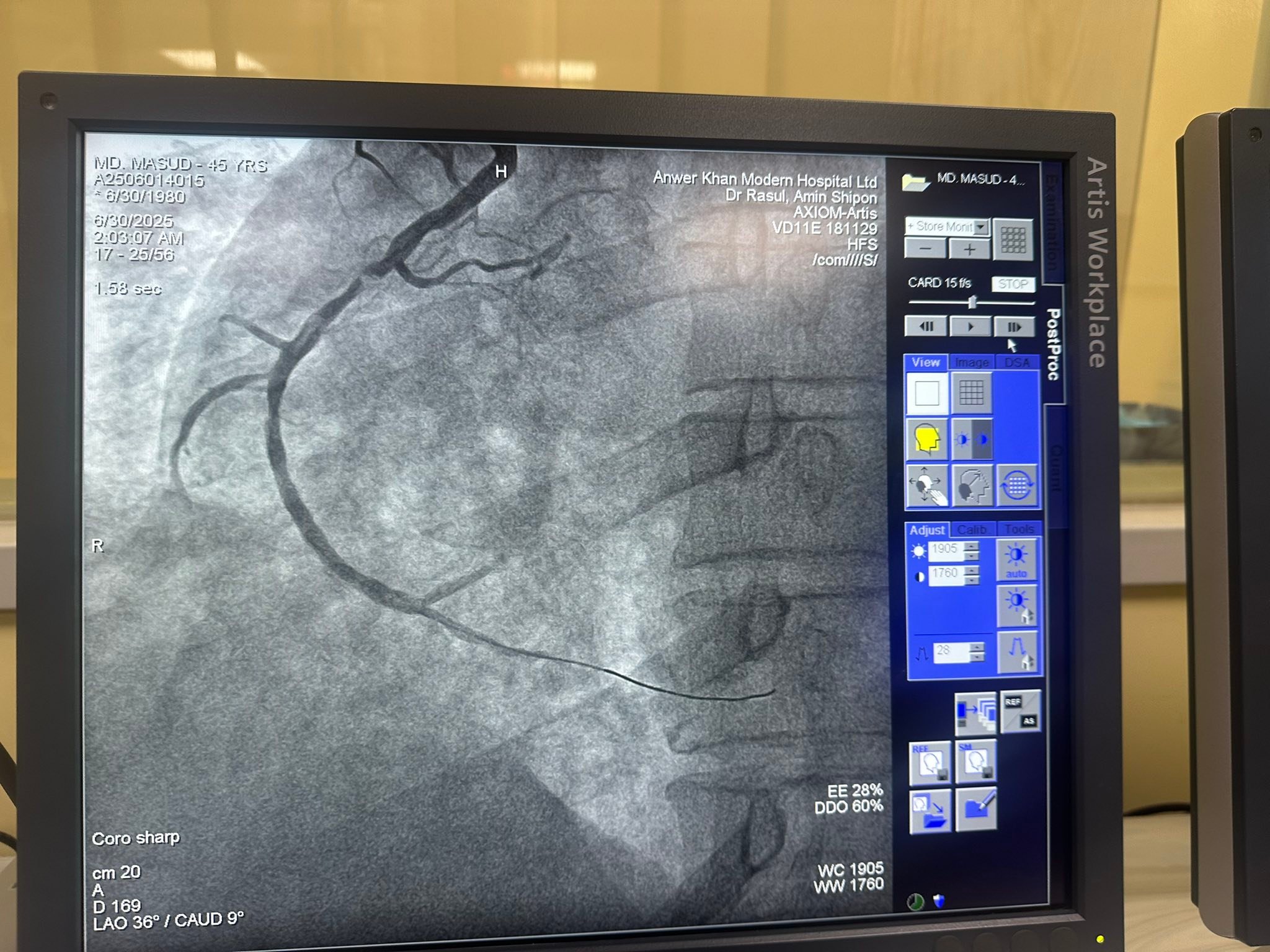Dr. Md Rasul Amin Shepon, Interventional Cardiologist | Dhaka