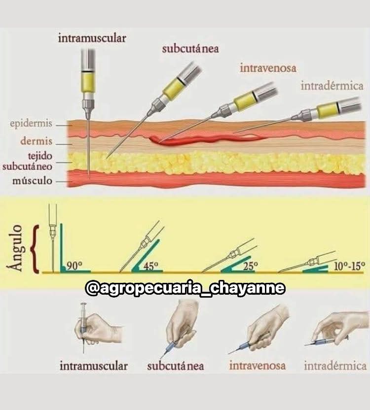 como inyectar la l carnitina L´Carnitina Inyectable Subcutánea . . Importaciones Imphersal Dir: Maldonado S / 1084, Quito 0985900953/0998294731/0999556421 #cunas #juguetes #hogar #cuidadopersonal #coches #ropa # ferretería #evitacoronavirus #labialmujer #vellofacial #belleza Capsule:120 Capsule PORE CONTROL Biomarkers for early identification