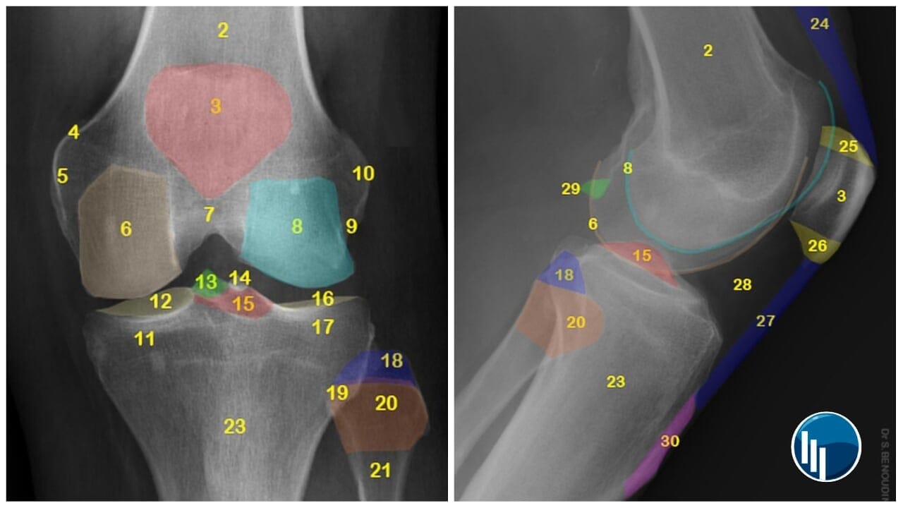 Radiologia - 30 elementos se distinguien en la anatomía normal de la ...