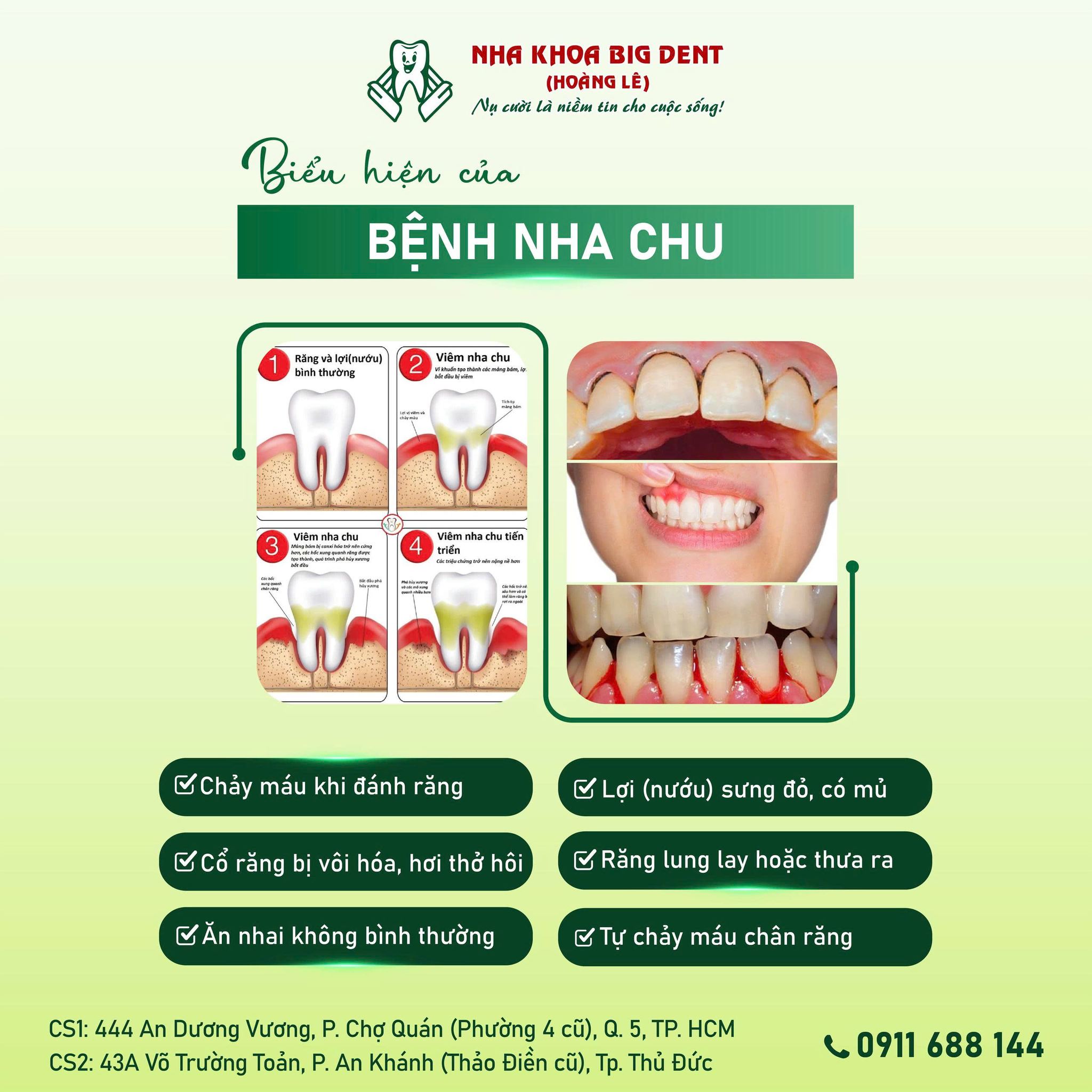 Nha Khoa Big Dent - Hoàng Lê | Ho Chi Minh City