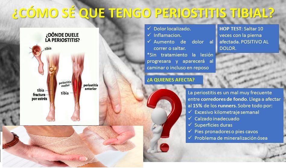 La periostitis es la inflamación aguda del periostio o de la membrana ...