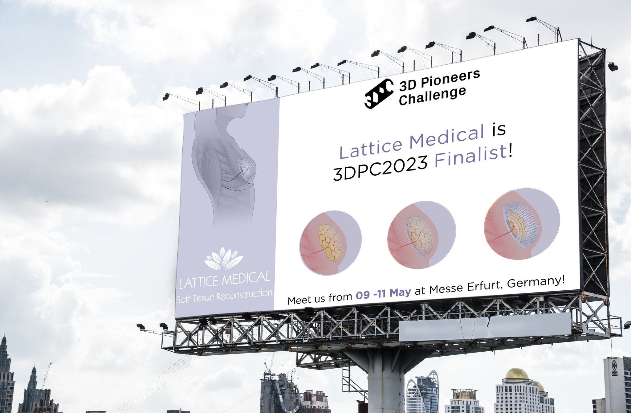 Lattice Medical - 🏆 3D Pioneers Challenge 2023 FINALIST! 🏆...