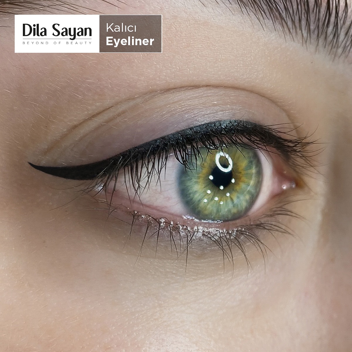 Dila Sayan Etlik | Ankara