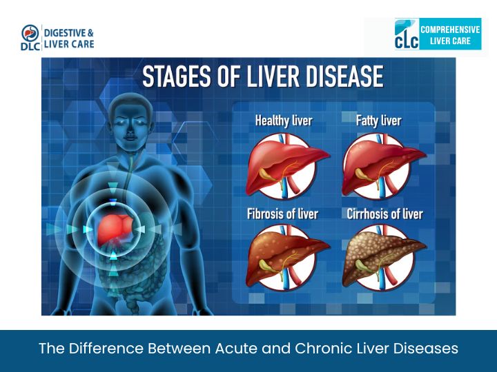 Dr.Harikumar - Learn the key differences between acute and chronic ...