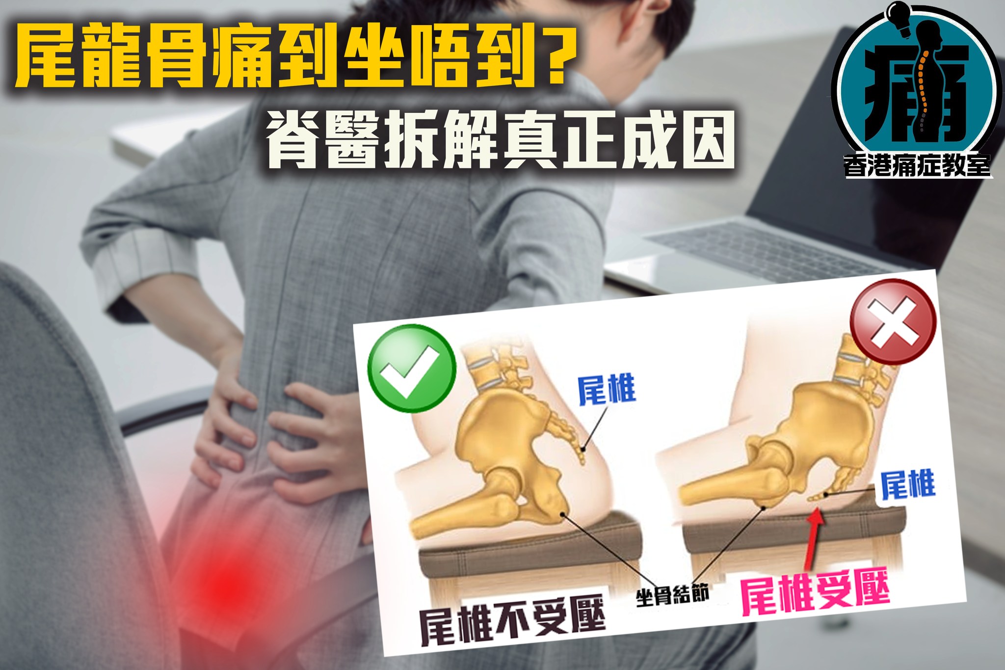 香港痛症教室 - 【尾龍骨痛到坐唔到！ 脊醫拆解真正成因】 #每次坐低起身都需用好大勇氣 #盡早矯正斬斷痛根... | Facebook