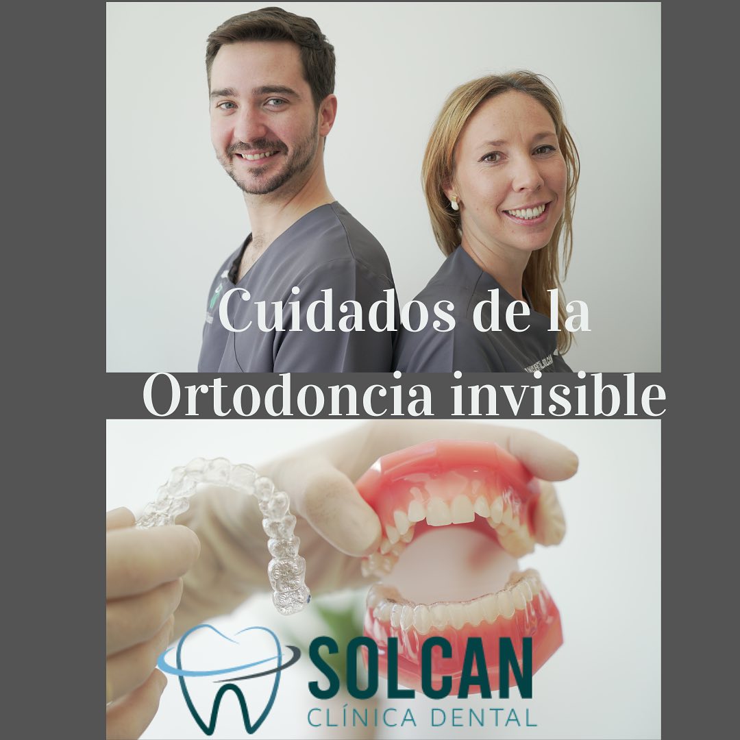 Solcan Dental - Todo lo que debes saber para sacarle el...