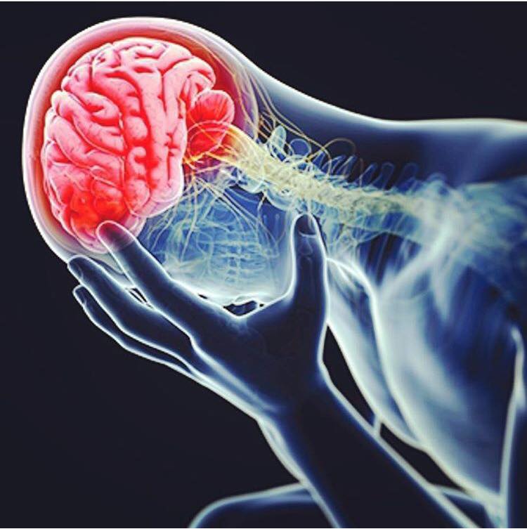 JBS Athletic Therapy - Concussions - they've had an increasing amount ...