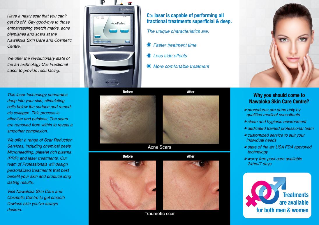 Nawaloka Hospital Colombo - If not treated early, acne (pimples) can ...