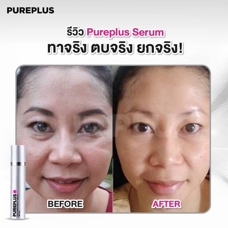 Pureplus Bangkok Shop ลดฝ้า กระ รอยหมองคล้ำ หน้าวีเชฟ