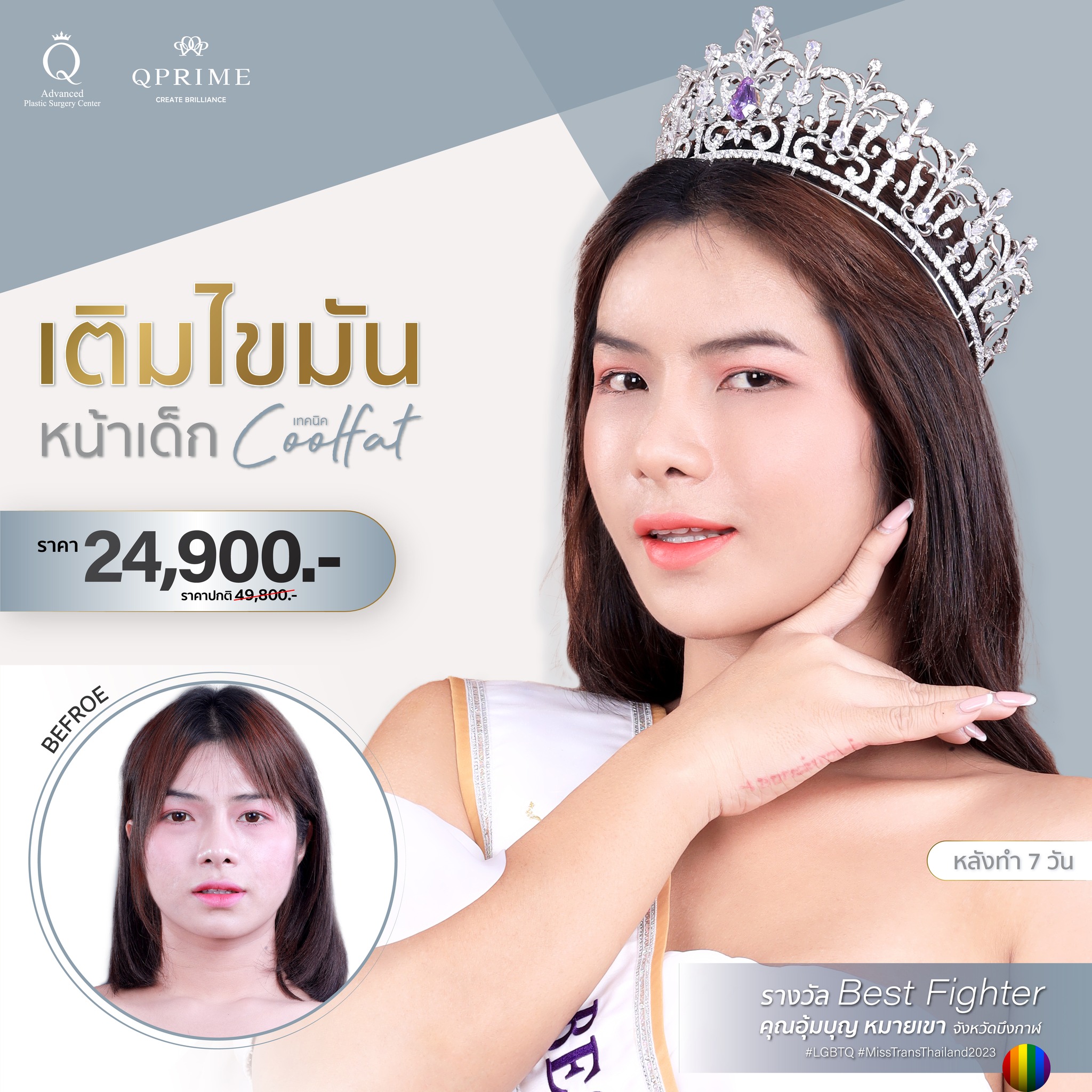 นวัตกรรมสุดล้ำสมัย... - Qprime คิวไพร์ม ศัลยกรรมตกแต่งเฉพาะทาง | Facebook