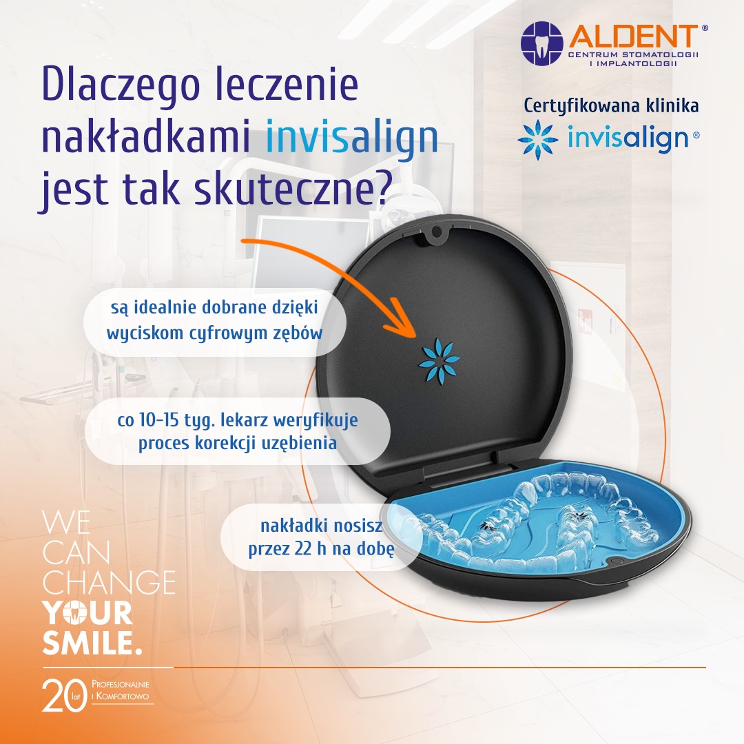 Leczenie... - Aldent - Centrum Stomatologii i Implantologii