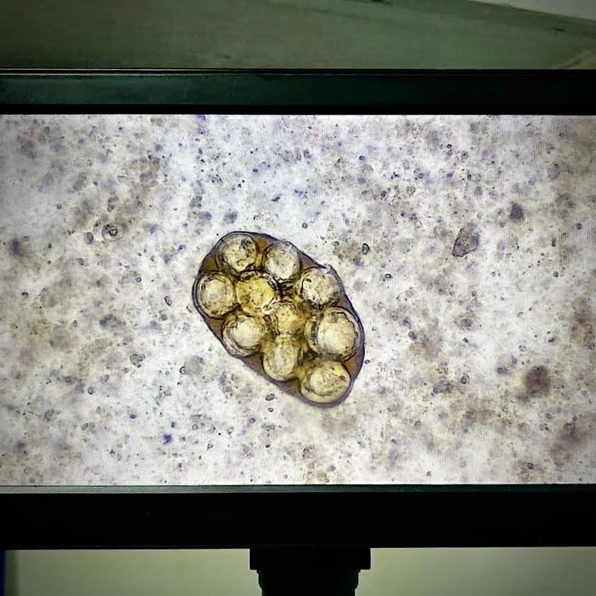 Serbisyo - 🦠 What’s this on our microscope? You’re looking at parasite ...