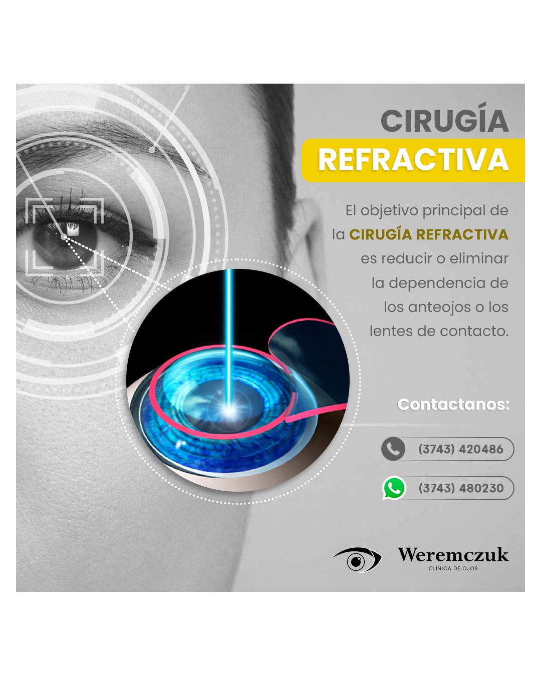 👉🏼 La cirugía refractiva... - Clínica de Ojos Puerto Rico S.A | Facebook