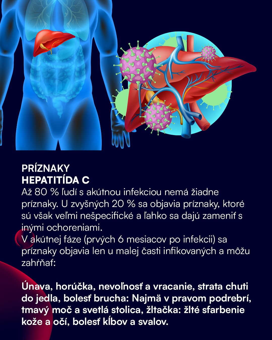 hiv-aids-slovensko-checkpoint-hiv-bratislava