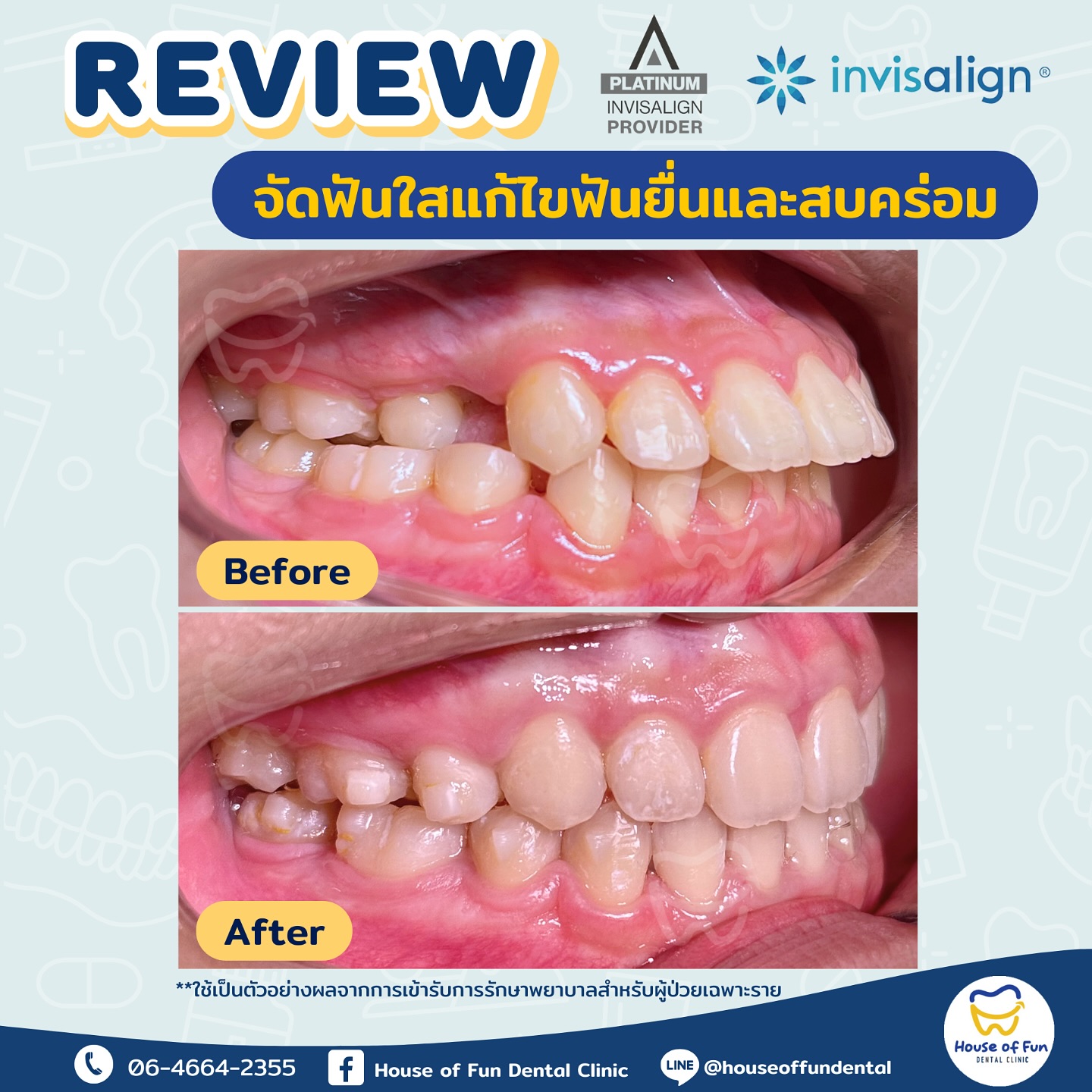House of Fun Dental Clinic - คลินิกทันตกรรมเฮาส์ออฟฟัน | Facebook