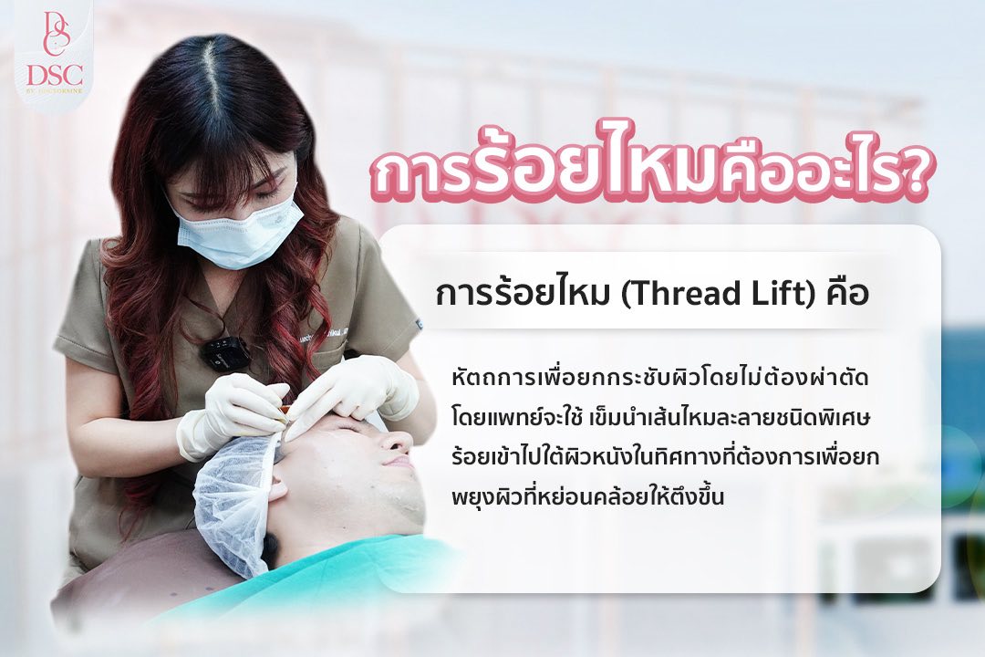 💐การร้อยไหมคืออะไร? การร้อยไหม (Thread Lift) คือ หัตถการเพื่อยกกระชับ ...