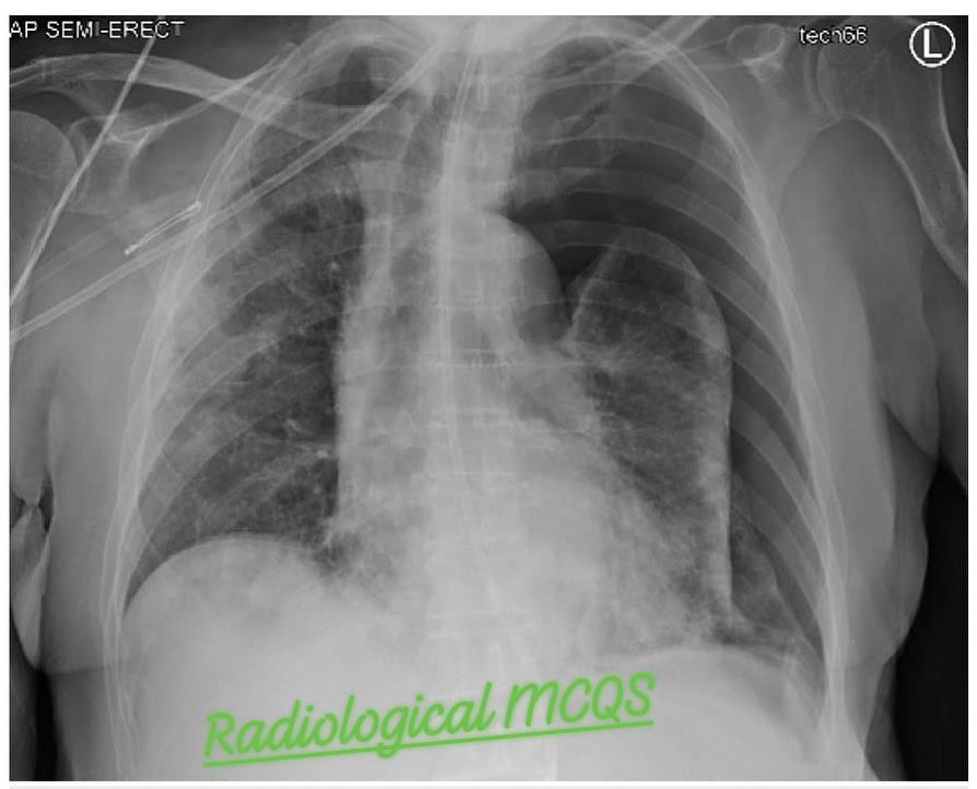 Radiological - 72-year-old male with multiple comorbidities such as ...