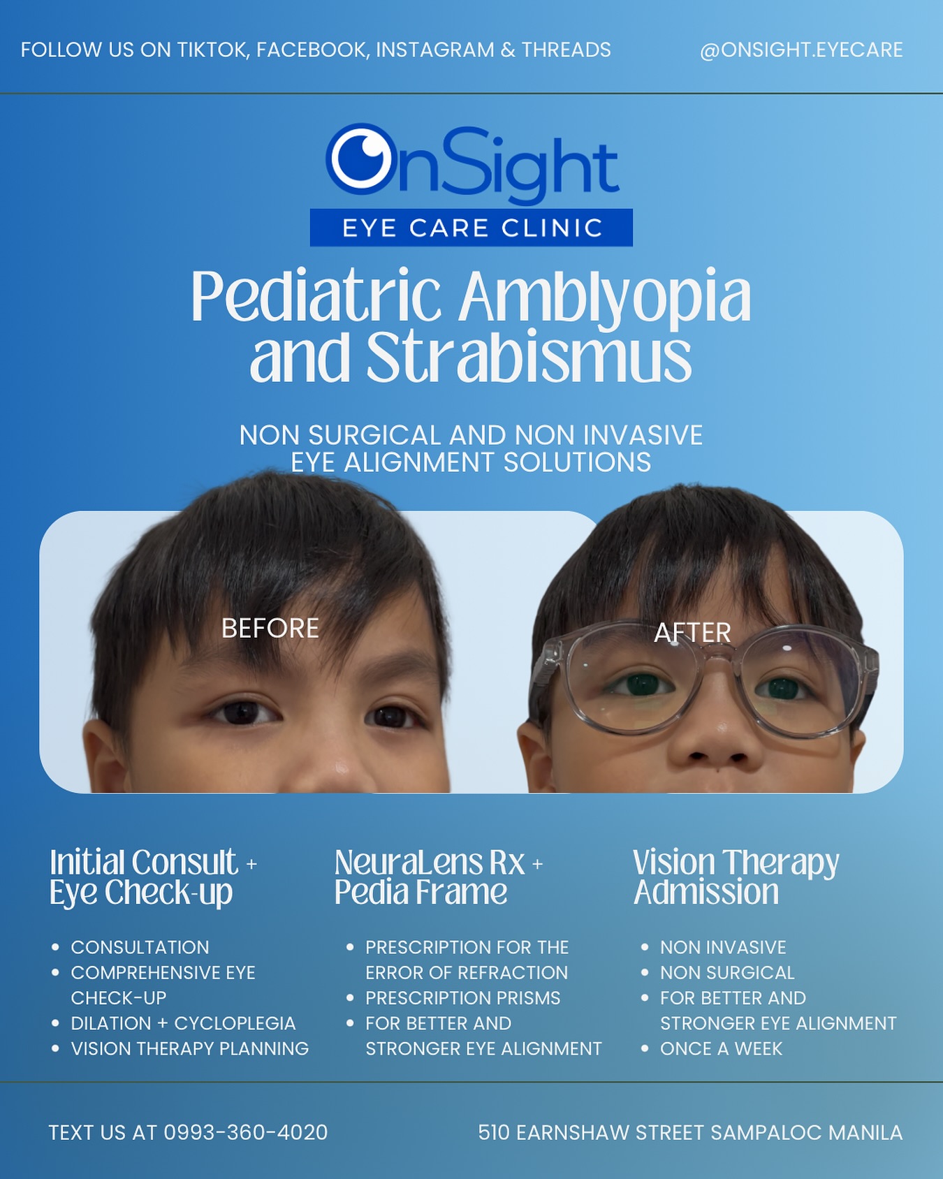 OnSight - Amblyopia and strabismus non surgical and non invasive ...