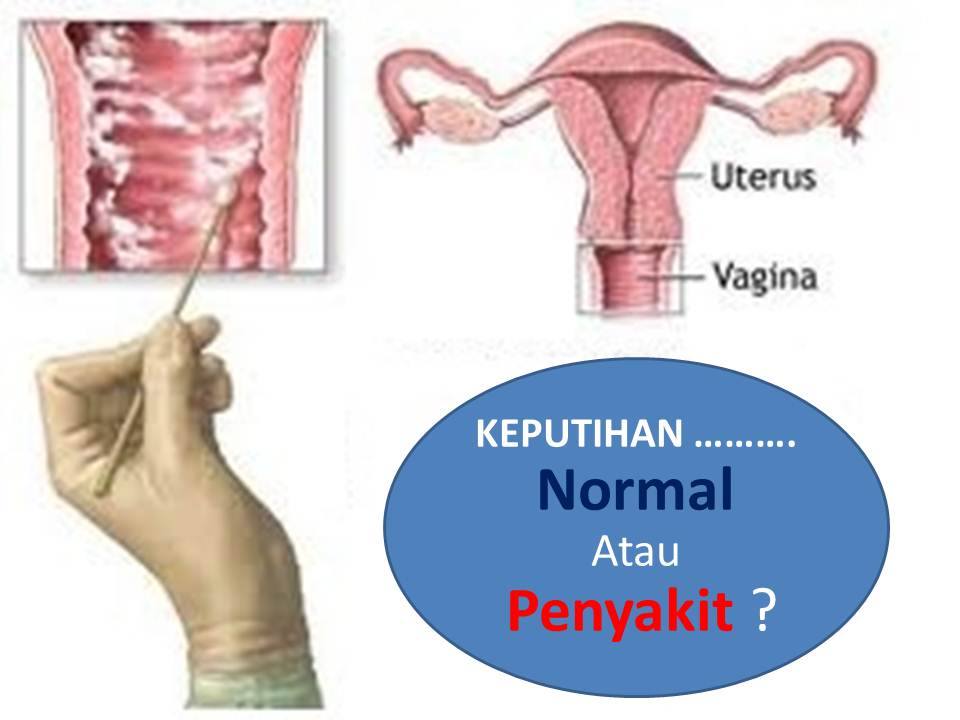 Marina Beauty Jsd Kenapa Masalah Keputihan Perlu Dirawat Masalah Keputihan Wanita Adalah Merupakan Antara Masalah Kesihatan Yang Sering Dialami Oleh Kebanyakan Wanita Keputihan Wanita Adalah Merupakan Masalah Yang Kedua Sesudah Masalah