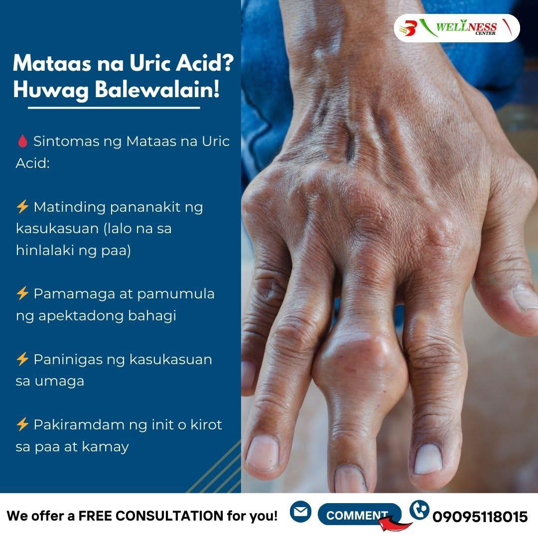 Brigada - Ang mataas na uric acid ay maaaring humantong sa gout—isang ...