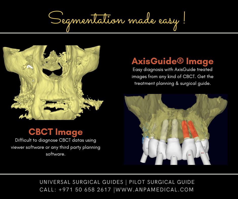 AxisGuide - Introducing AxisGuide® Image Treatment and... | Facebook