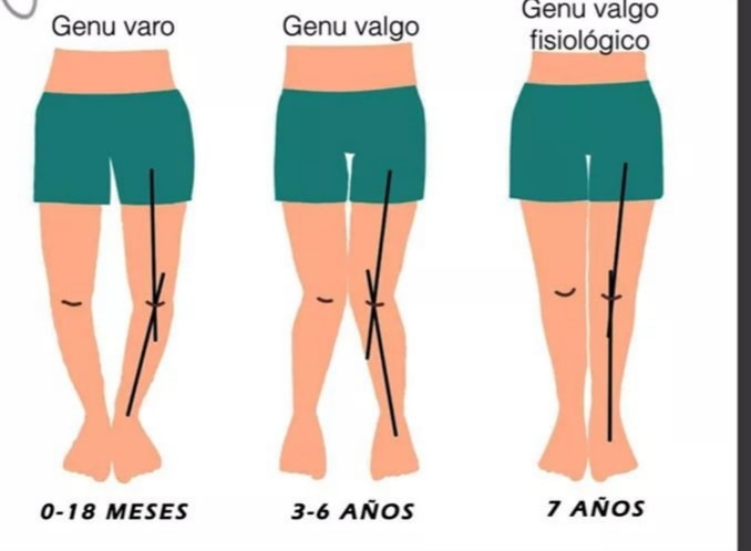 🔵... - Fisiovíva Centro de Terapia Física y Rehabilitación