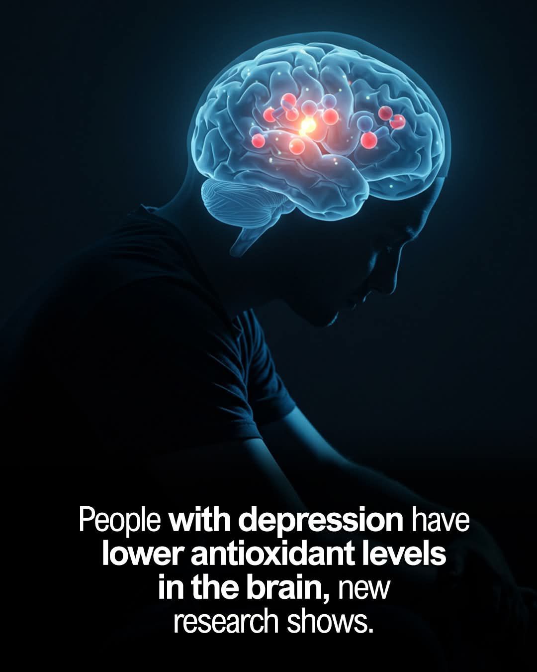 Could depression be (also) caused by oxidative stress? 🤔 A team of researchers conducted a meta-analysis to explore this. They found that people with depression had lower levels of glutathione—a key antioxidant—in