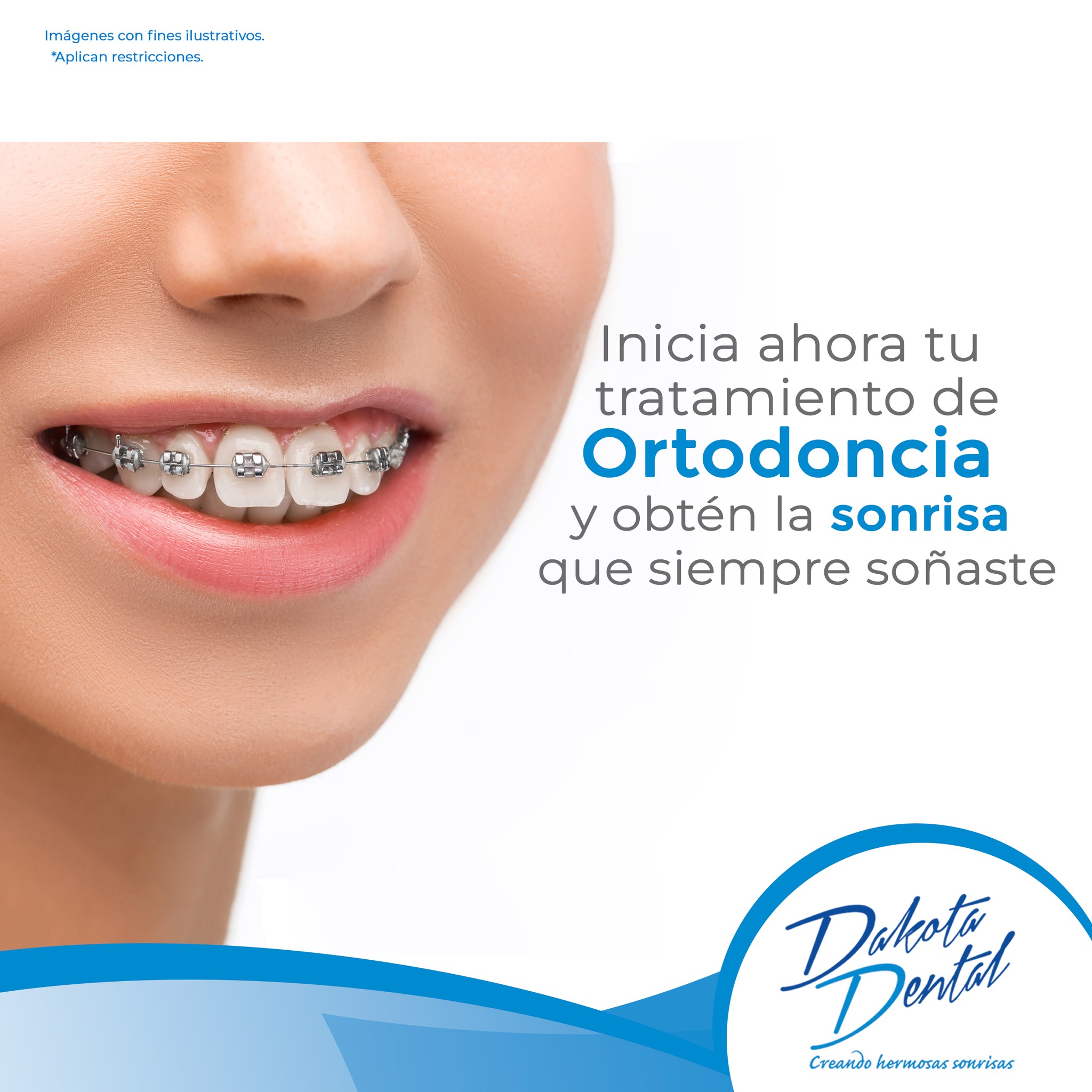Dakota - La ortodoncia tiene muchos beneficios para ti. ¡Comienza ya tu ...