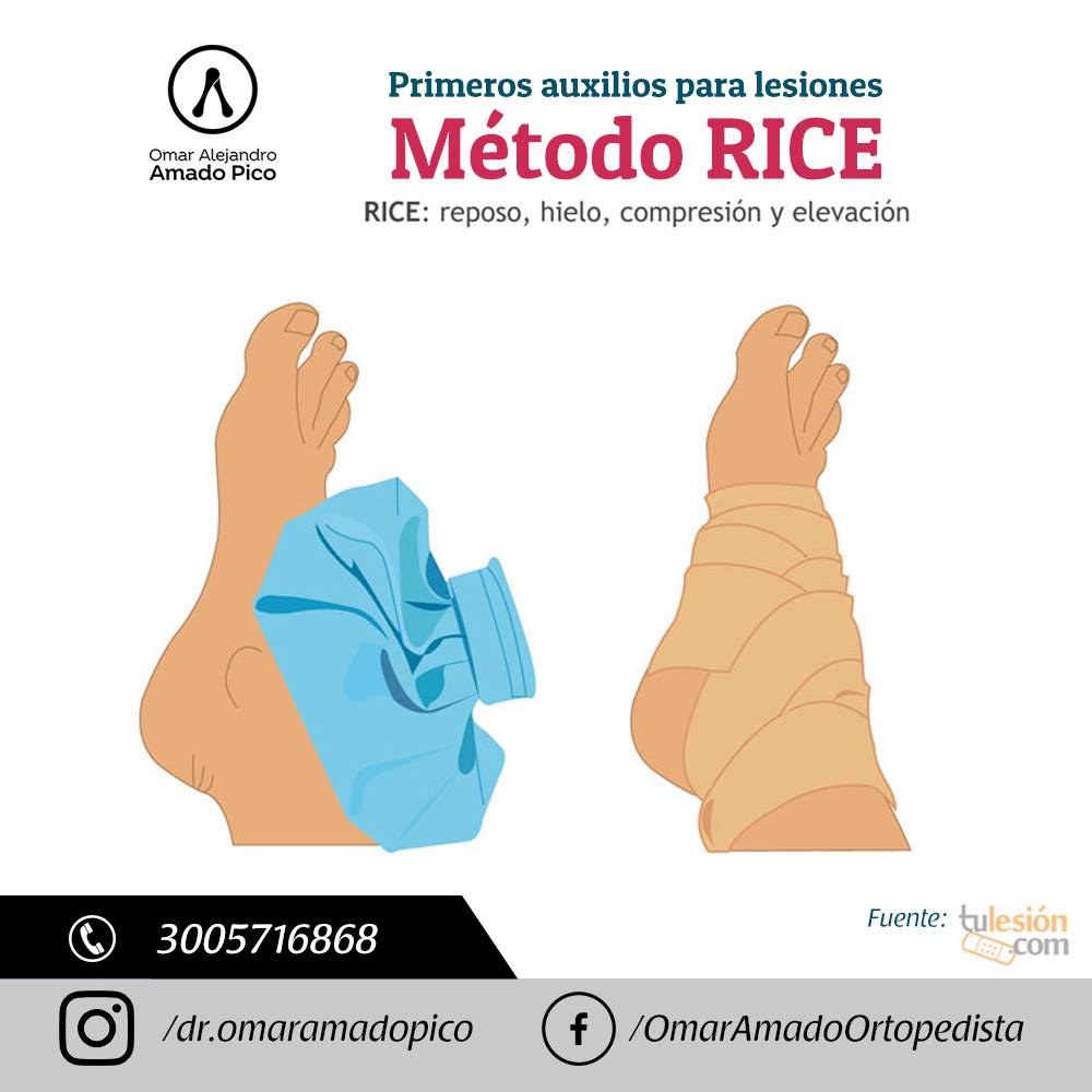 El método RICE es un tratamiento de... - Dr. Omar Amado Pico | Facebook