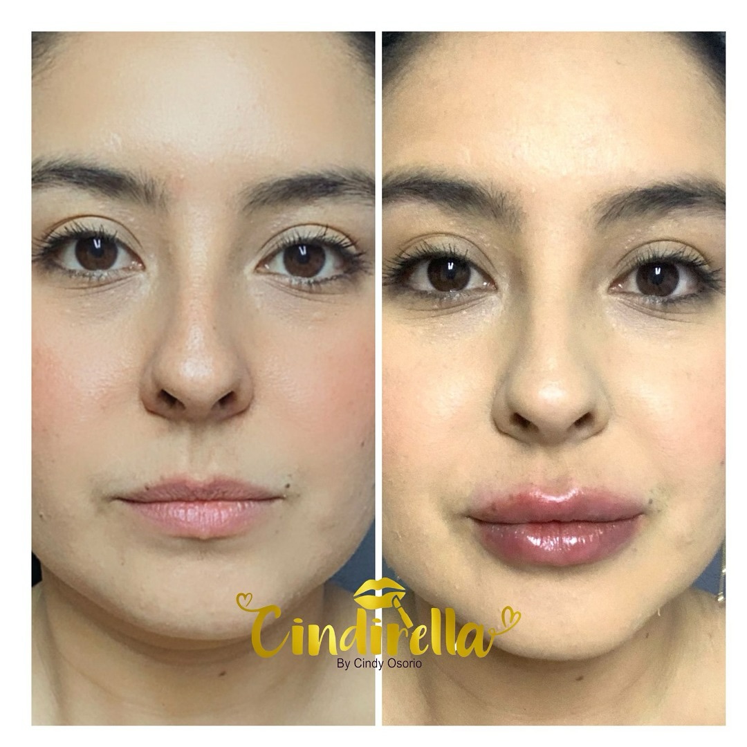 👄 ¡Labios perfectos! Descubre los... - Cindirellaspamed