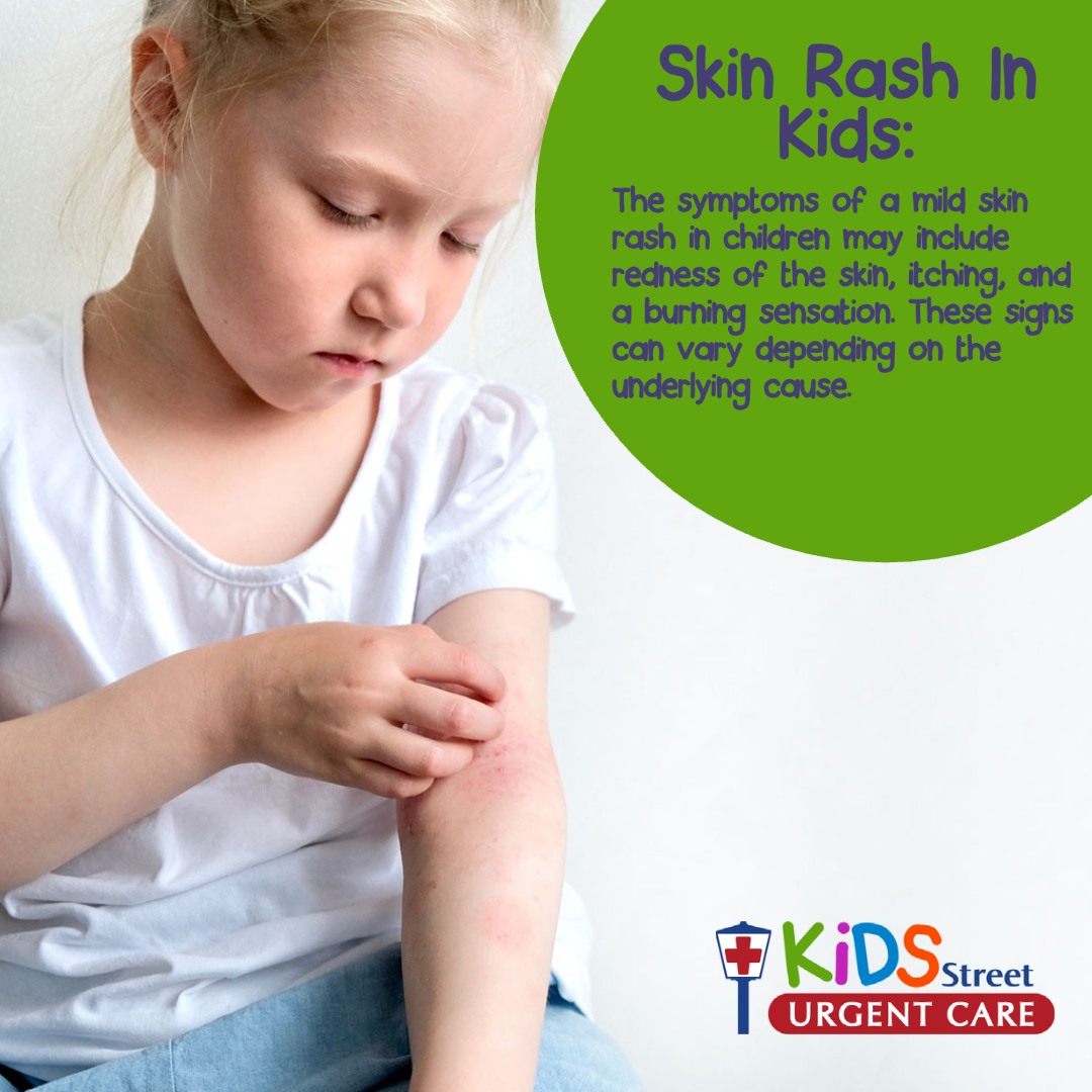 🌟 Skin rashes in kids:... - KidsStreet Urgent Care - Mobile