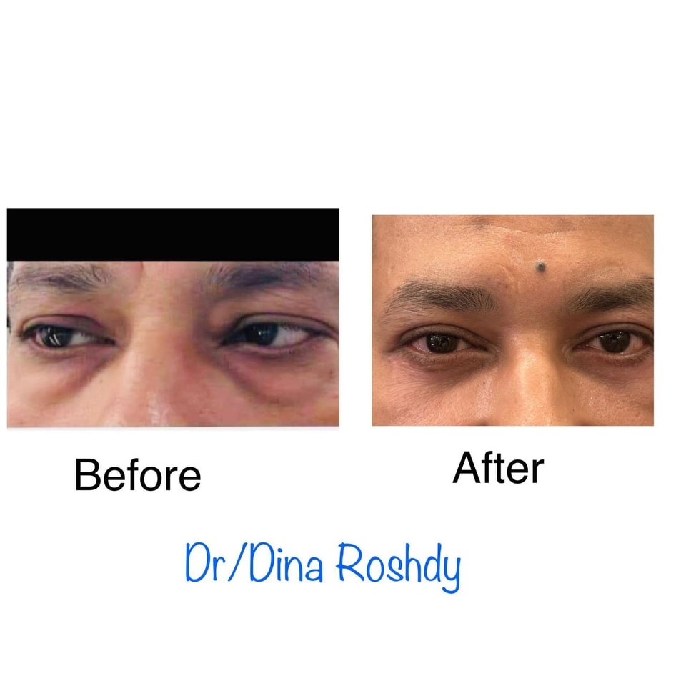Dr. Dina Roshdy - دكتور دينا رشدي