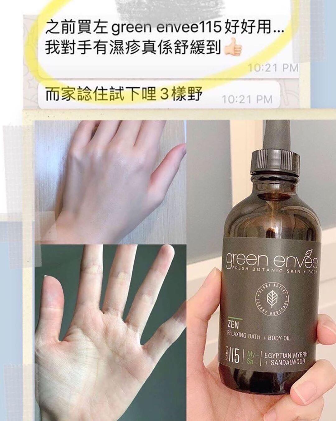 🏻4大抗炎成份對抗濕疹．發炎．極乾肌膚🏜】... - Deerville Organics 鹿小鎮