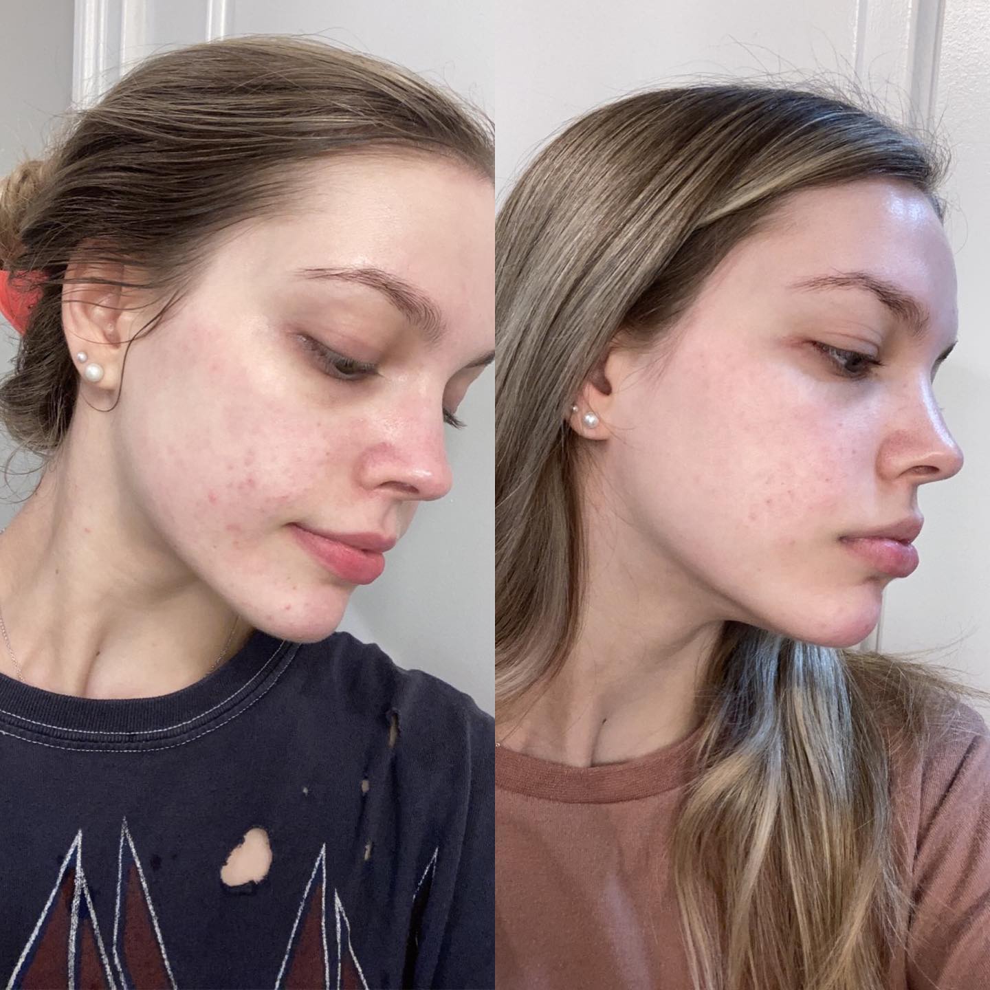 Skin by Addison - Happy Monday! Here’s a little chemical...