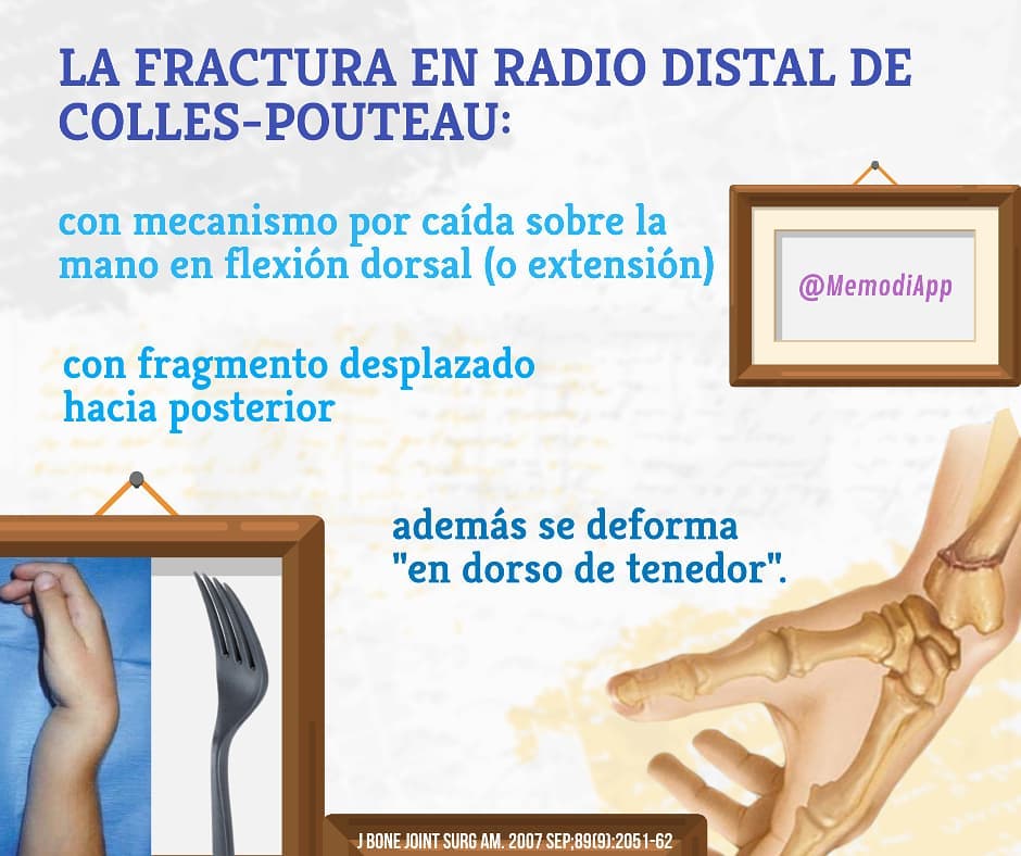 Memodi - La fractura en radio distal de Colles-Pouteau: con mecanismo ...