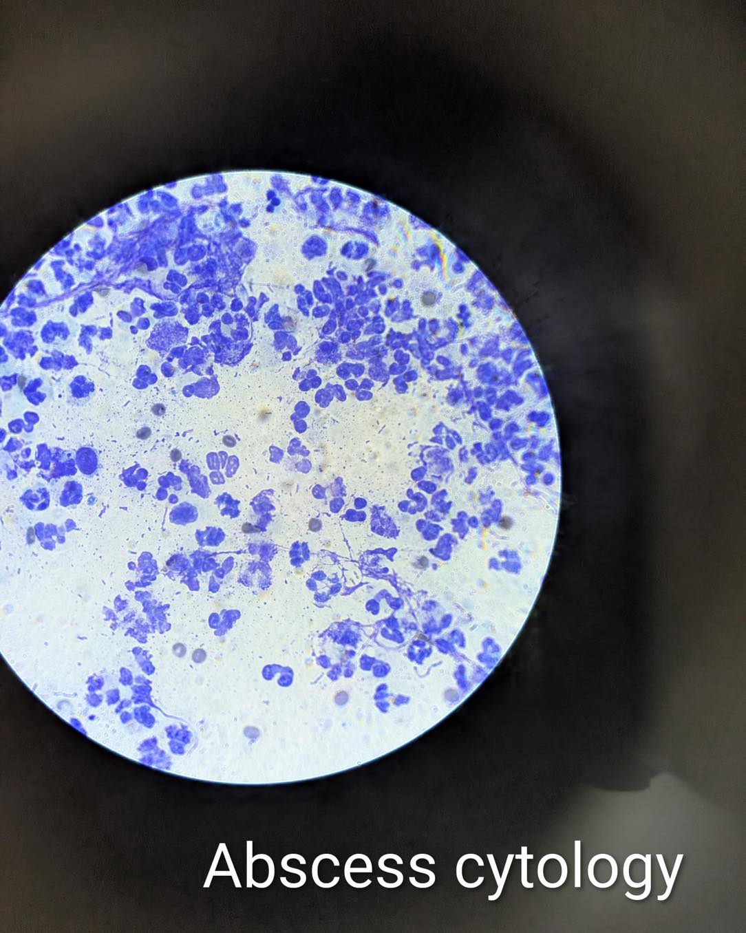 Country - Trivia Tuesday!!! What’s under the microscope?! A: Abscess ...