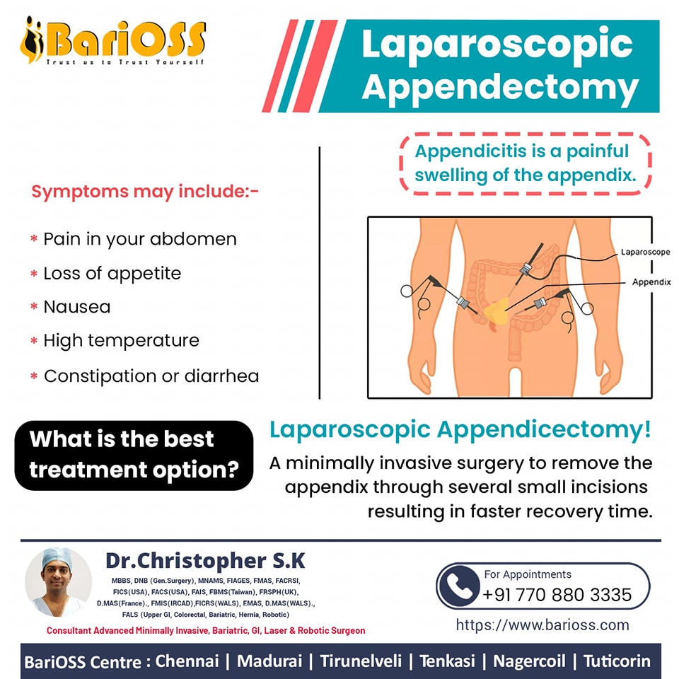 📢 Recognize the Signs of Appendicitis! 📢 Appendicitis is no joke, and ...