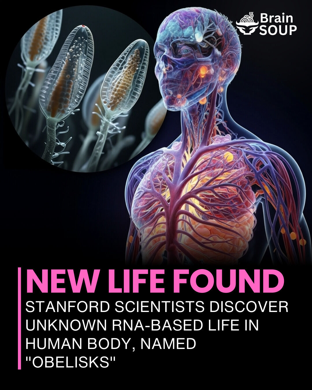 Brain soup - Stanford scientists have uncovered a... | Facebook
