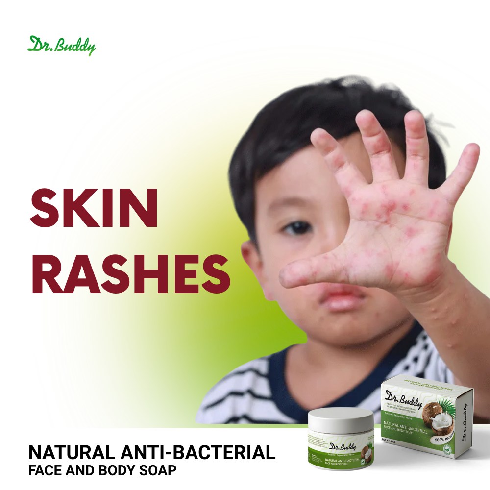 Dr. - 𝗦𝘁𝗼𝗽 𝘁𝗵𝗲 𝗥𝗮𝘀𝗵, 𝗦𝘁𝗮𝗿𝘁 𝘁𝗵𝗲 𝗥𝗲𝗹𝗶𝗲𝗳! Skin rashes? Don’t scratch it ...
