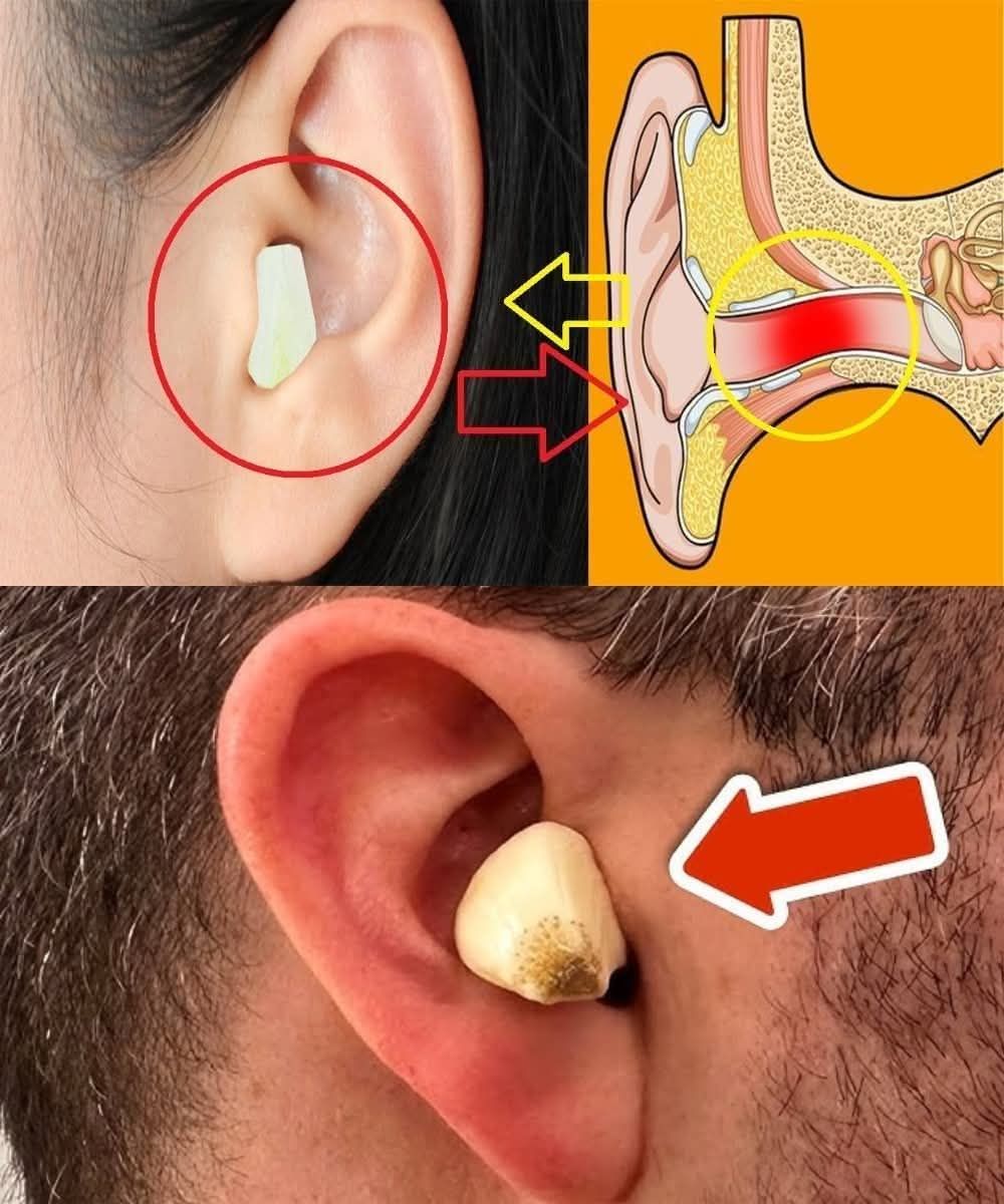 glutathione ear infections 👂 Boost Your Health Naturally! Did you know the right foods can support healthy hearing? 🥦🍊🥛 Include these superfoods in your diet for better ear health: ✓ Oranges 🍊 glutathione memory Frontiers Glutathione badge_New Launch_#313652_#ffffff Skincare effect:Pore refining