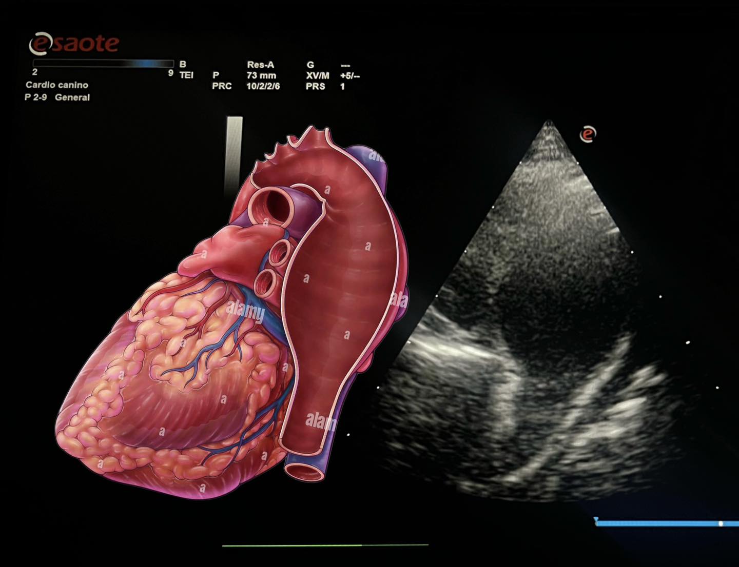 ANEURISMA de la Aorta torácica... - CARDIOVet - El Salvador