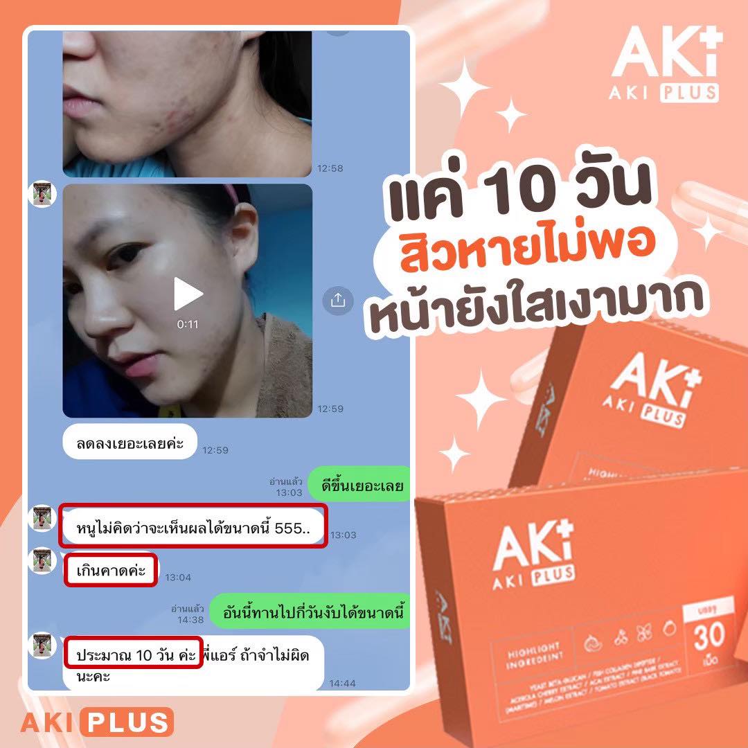 10 วัน ก็จึ้งเเล้วววว !... - AKI PLUS - เพจหลักบริษัท