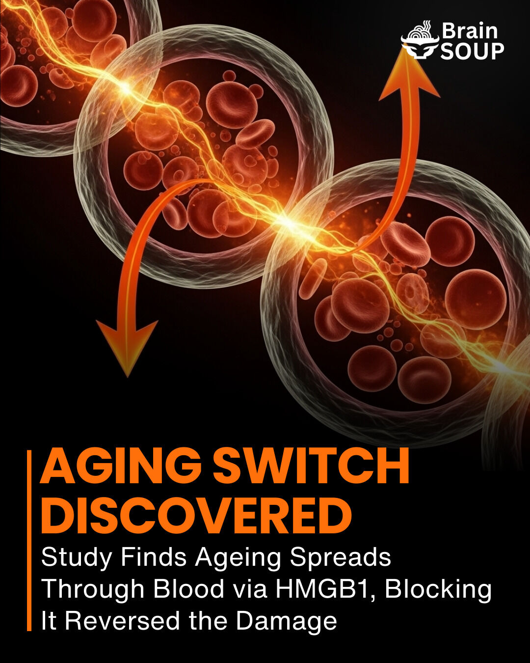 Brain - Scientists have discovered that aging spreads through the ...