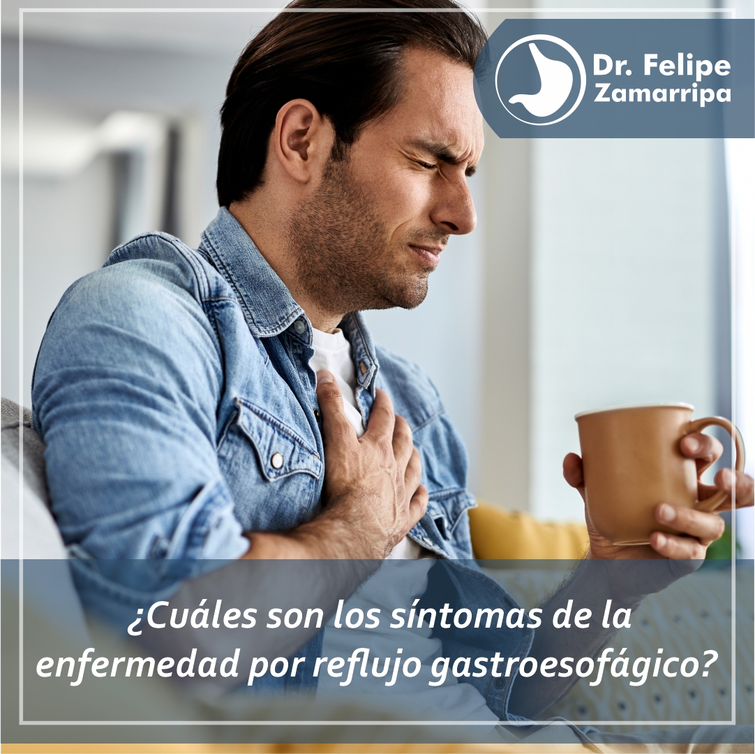 Dr. - Los síntomas de la enfermedad por reflujo gastroesofágico se ...