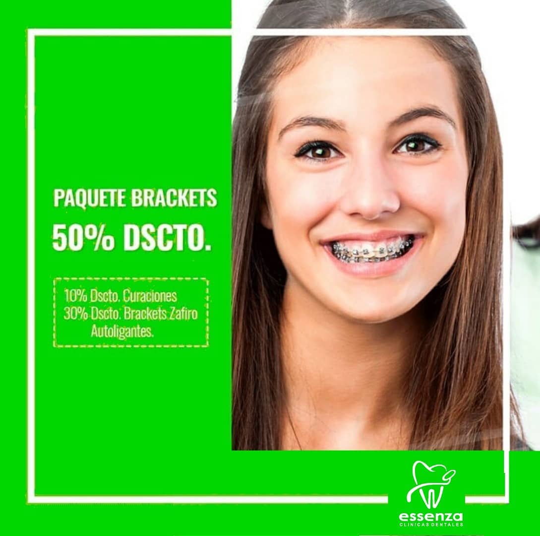 🎁 Paquete MODA BRACKETS 😁 .... - Essenza - Clínicas Dentales