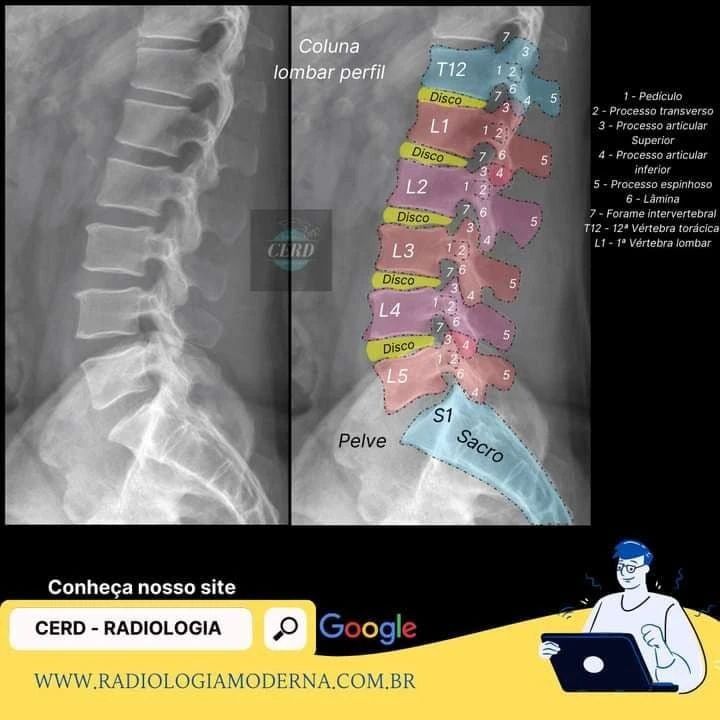Radiografia Da Coluna Lombar Foto De Raiox De Coluna Toracolombar Ap